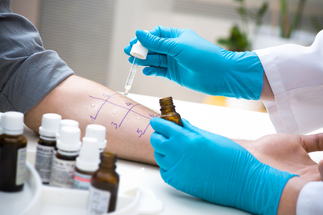 Allergologia